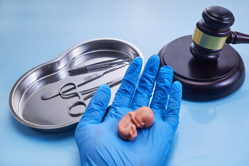 Reproduction laws and abortion or fetus rights. Medical Ethics Debate