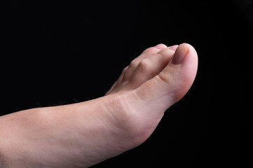 Fototapeta premium Barefoot feet, on black background. Close-up shot of healthy beautiful female feet. Health and beauty concept. Top view of human foot with neutral manicure or pedicure
