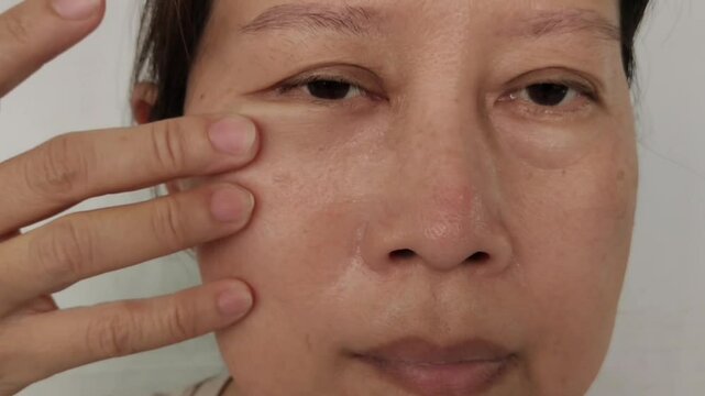 portrait the fingers holding the wrinkles and scar, Flabby skin and creases, swelling and ptosis under the eyes, dark spots and blemish, freckles and Flabby skin on the face, health care and beauty.