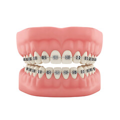 braces isolated on white