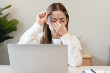 Eye problem concept, fatigue asian young woman tired eyes, irritated rubbing eye dry relief vision...