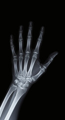 x ray of human hand