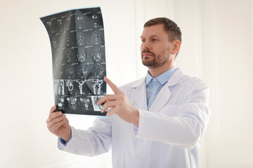 Doctor examining brain MRI scan in clinic