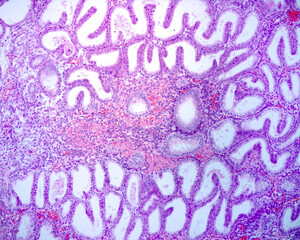 Endometrium. Secretory phase