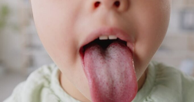Happy funny kid, little child opening mouth showing tongue, small patient passing health check-up in pediatric otolaryngology clinic, medical aid, otolaryngologist examine, throat pain complaints