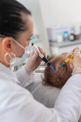 Alopecia. Man hair loss improve growth treatment regeneration, dermapen microneedling, vitamin...