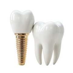 A detailed dental implant model with a visible screw thread stands next to a pristine white tooth, showcasing modern dentistry on a bright, clean background.