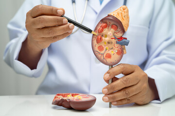 Chronic kidney disease, doctor with model for treatment urinary system, urology, Estimated...