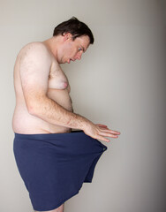 A man with a large belly is wearing a blue towel and is looking at the camera