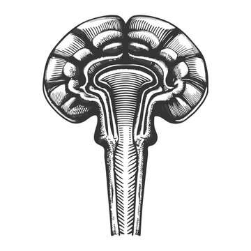 tracing the spinothalamic tract, showing how pain and temperature signals travel from the body through the spinal cord to the brain diagram hand drawn schematic vector.
