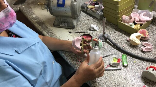 Close-Up of Dental Lab Hands Working on Wax Denture with Flame