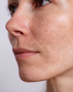 Macro image of combination skin with both oily and dry zones. Natural lighting on a white background.