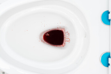 Blood from hemorrhoids or menstruation in the flushed. Clean flush toilet after the stools that are...