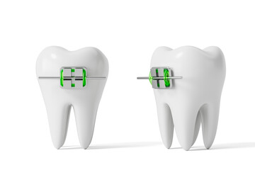 3D rendering of two white teeth with green and silver dental braces on a clean white background, showcasing orthodontic treatment concept clearly. 3D Rendering