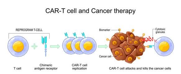 CAR T-cell therapy. Process of Cancer immunotherapy.