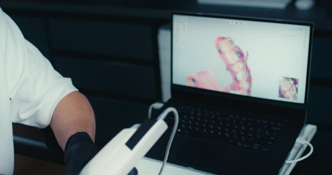 Dentist performing 3D oral scanning with an intraoral scanner in a modern dental clinic. Concept dental technology, 3D scanning, professional care, modern dentistry.