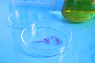 Petri dishes with samples on light blue table, closeup