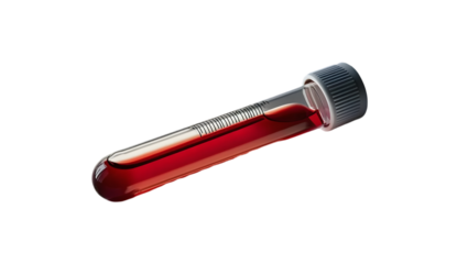 Blood in Test Tube