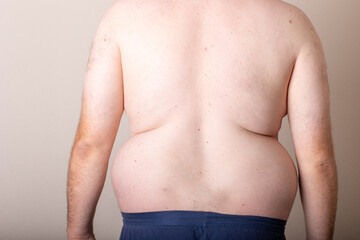 A man with a large belly is standing in front of a white wall