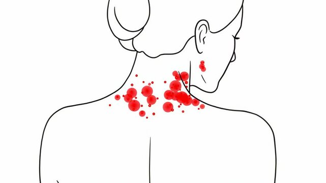 Woman with red marks on neck in a minimalist illustration  