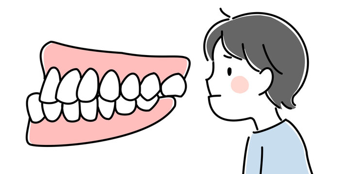 受け口（反対咬合）で困っている子供と歯並びのイラスト