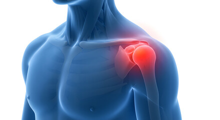 Shoulder Pain Illustration - Anatomical Visualization