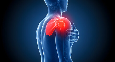Shoulder Pain Anatomy: Highlighted Scapula and Joint Inflammation