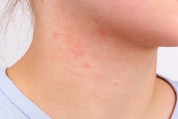 Macro View of Skin Under Jaw Featuring Faint Red Markings Highlighting Texture and Condition, Revealing Subtle Variations in Skin Tone and Surface Imperfections Common in Skin Health Examinations