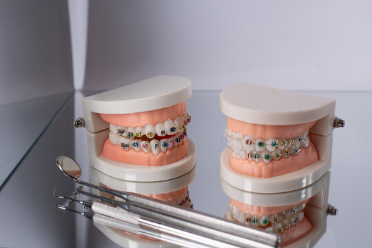 Dentist with Orthodontic tooth model and bracket or brace. Clean and Scrape off tartar. May Orthodontic Health Day, March Oral health, Dentist Day, False Teeth. Toothache and Children Dental Health