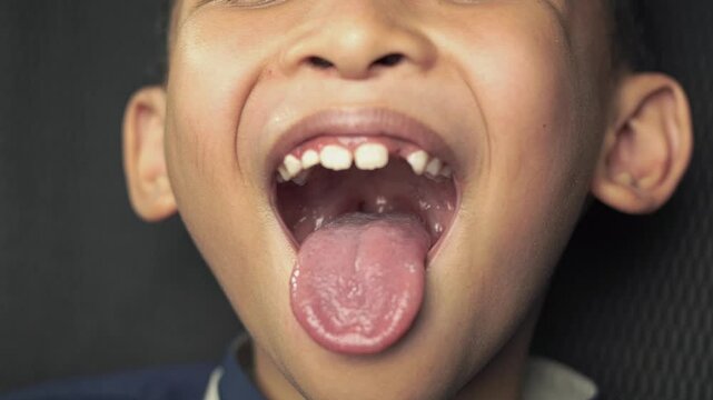 Close-up of little boy opening her mouth wide to show her throat. Child is sitting with wide open mouth, with a tongue stuck out, view on the uvula and the soft palate.
