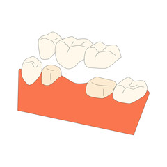 Denture