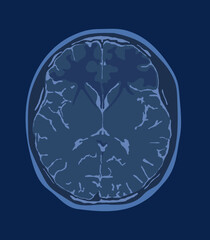 Normal human brain mri examination. Top view of human brain anatomy.