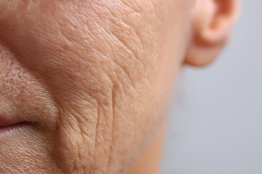 Close-up of part of an elderly woman's face, focusing on the wrinkled texture of her skin.