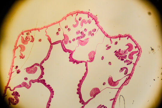 Metridium sea anemone section showing gastrovascular cavity and mesenter