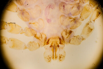 Dermacentor andersoni tick under microscope