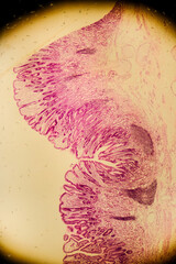 Human stomach tissue under microscope showing gastric glands and muc