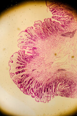Human stomach tissue under microscope showing gastric glands and muc