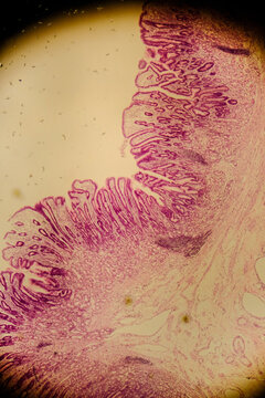 Human stomach tissue under microscope showing gastric glands and muc