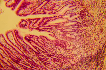 Human stomach tissue under microscope showing gastric glands and muc