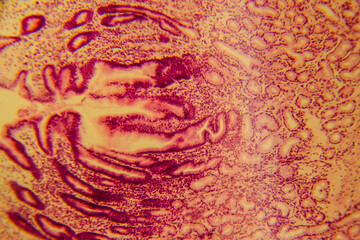 Human stomach tissue under microscope showing gastric glands and muc