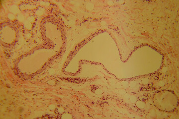 Human stomach tissue under microscope showing gastric glands and muc