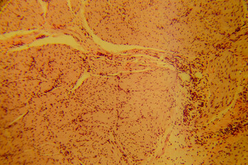 Human stomach tissue under microscope showing gastric glands and muc