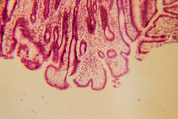 Human stomach tissue under microscope showing gastric glands and muc