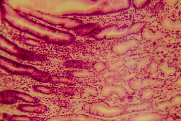 Human stomach tissue under microscope showing gastric glands and muc