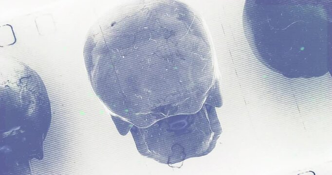 Human skull from the Paracas culture. Suitable for educational materials, historical presentations, and archaeological content related to ancient civilizations.
