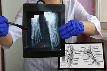 Doctor Displaying Foot X-ray and Anatomical Diagram