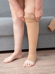 woman puts on medical compression underwear on her legs. Stockings to maintain the tone of veins and valves.