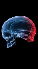Skull X-ray. Blue smoke effect, with red back of head isolated, on black background