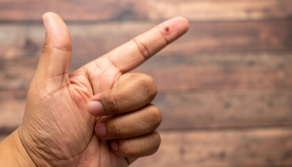 A hand is shown giving a thumbs-up gesture, with a small mark on the index finger against a rustic...