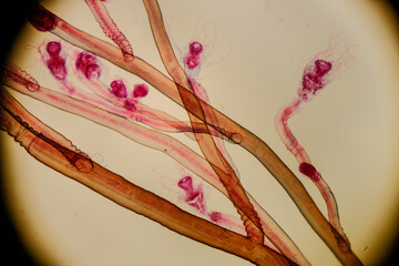  Eudendrium female colony with developing gonophores
